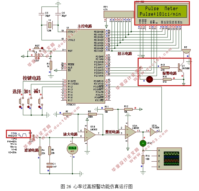基于51单片机脉搏测量仪的设计(附Proteus仿真,电路图,代码)